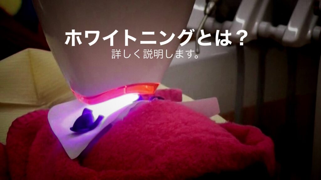 ホームホワイトニングの説明
